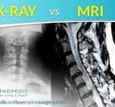 X-Ray, MRI, Medical imaging image